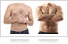 Coolsculpting treatment for men in fairfield, ct