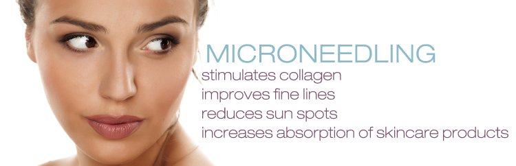 Microneedling Treatment with PRP in Fairfield
