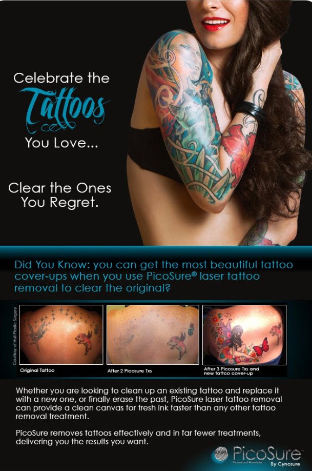 Picosure Tattoo Removal Reviews / Picosure Tattoo Removal Essex - Aesthetics of Essex - How old is the tattoo?