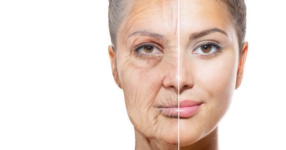 An aged woman representing anti-aging treatments at All About You Medical Spa in Fairfield CT.